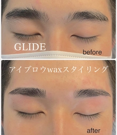 ビフォーアフター① by GLIDE【グライド】　EYEBROW＆BEAUTY新宿店