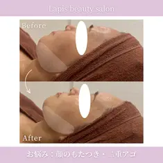 Lapis beauty salon　小顔リフトUP 