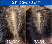 再髪ヘットスパコース+P1幹細胞培養上清頭皮美容液1本付¥27500→¥24200
