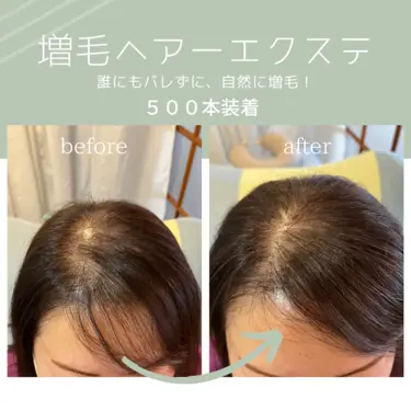 背景画像: 増毛ヘアーエクステ500本