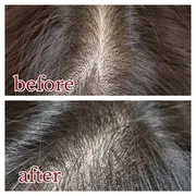 ■人気No. 1■【髪のボリュームが気になる方】頭皮改善ヘッドスパコース（150分）